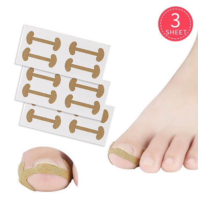 Ingrown Toenail Corrector Stickers