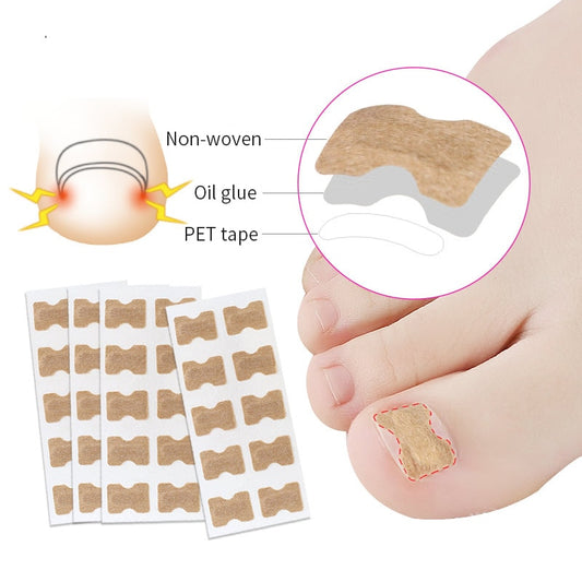 Ingrown Toenail Corrector Stickers