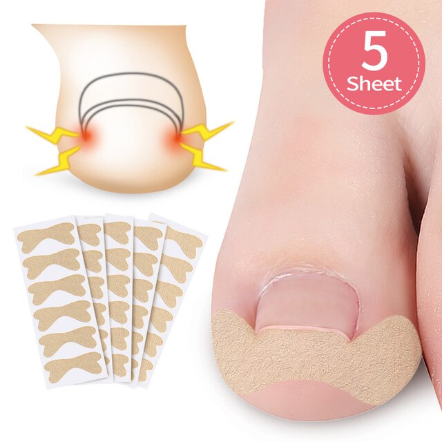 Ingrown Toenail Corrector Stickers